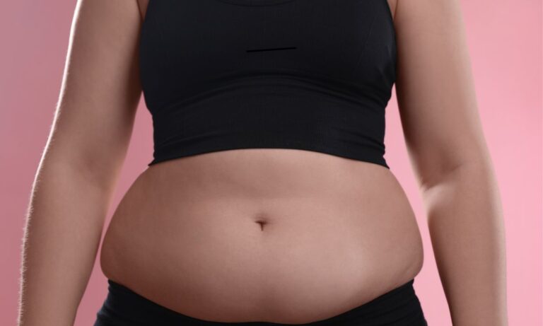 O que é lipodistrofia? Descubra os sintomas, causas e como identificar no seu corpo 2 Corpo feminino aparentando ter lipodistrofia.