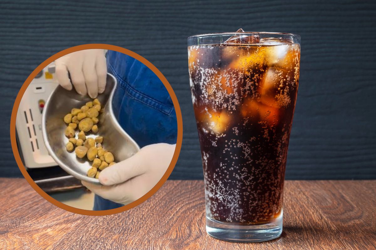 Beber muito refrigerante faz mal – Médico alerta após cirurgia assustadora 1 Cálculo renal removido de paciente e um copo de refrigerante de cola.