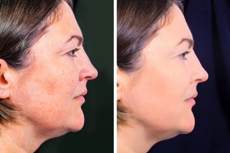 Sua pele é realmente o que você come? O que a ciência revela sobre dieta e envelhecimento da pele 6 dieta e envelhecimento da pele.