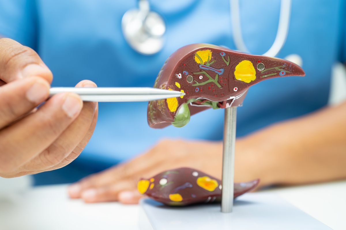 7 sintomas de gordura no fígado que exigem atenção imediata 1 Protótipo do fígado demonstrando formações de gordura.