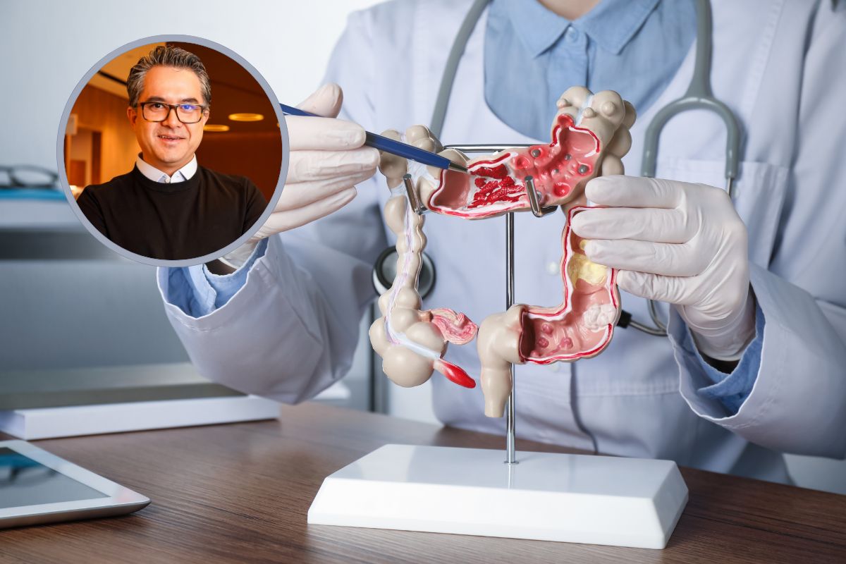 Precisamos falar mais sobre o câncer de intestino 1 Câncer de Intestino.