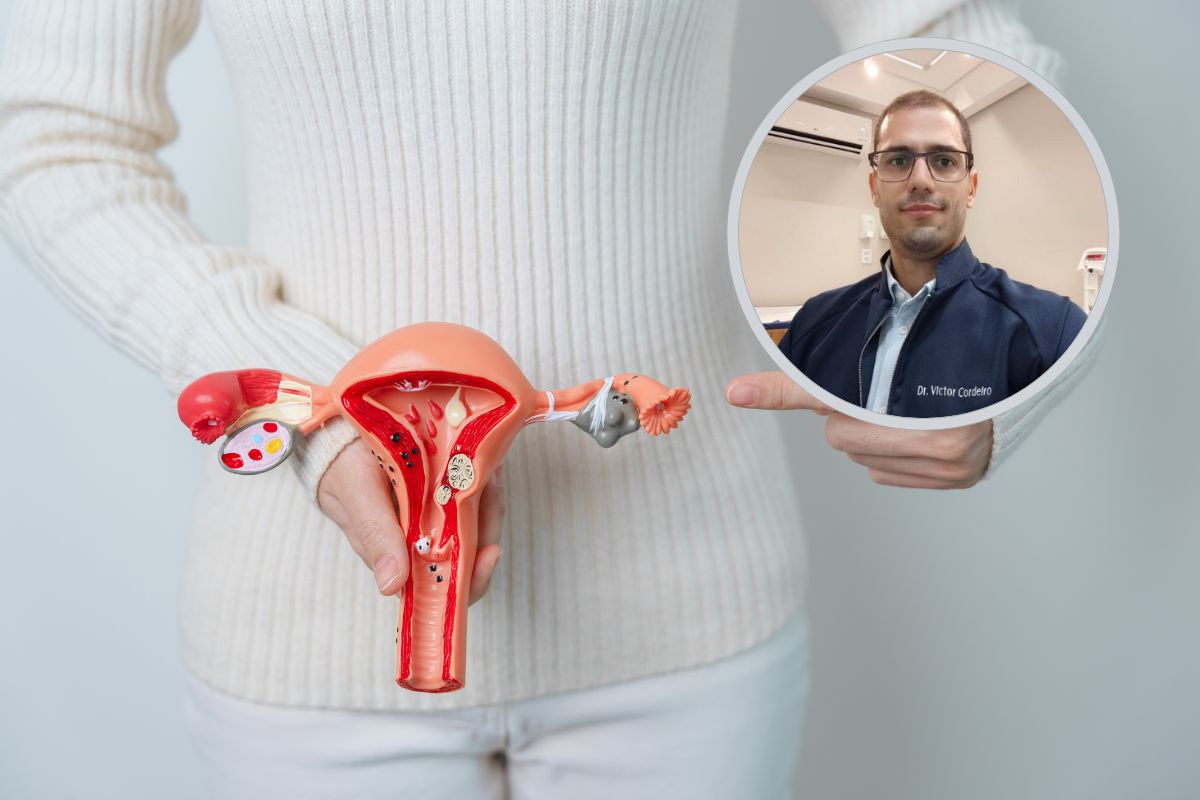 Câncer de ovário: o que toda mulher precisa saber 1 Câncer de ovário.