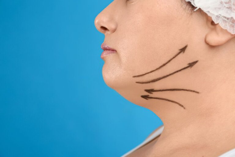 Como diminuir a papada? Descubra o que realmente funciona para reduzir 7 Como diminuir a papada.