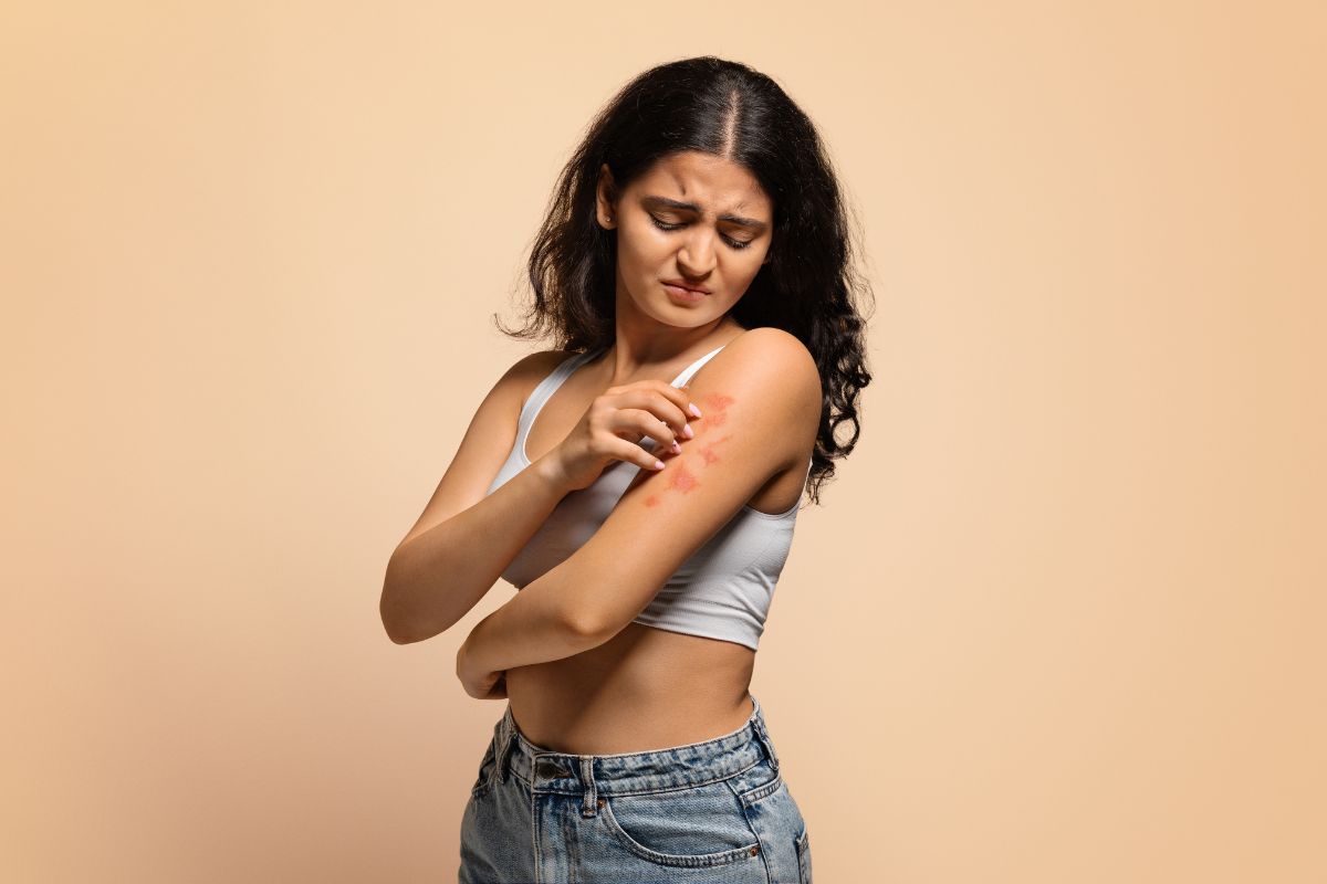 Dermatite atópica (eczema): o que é, sintomas, causas e como tratar 1 dermatite atópica ou eczema