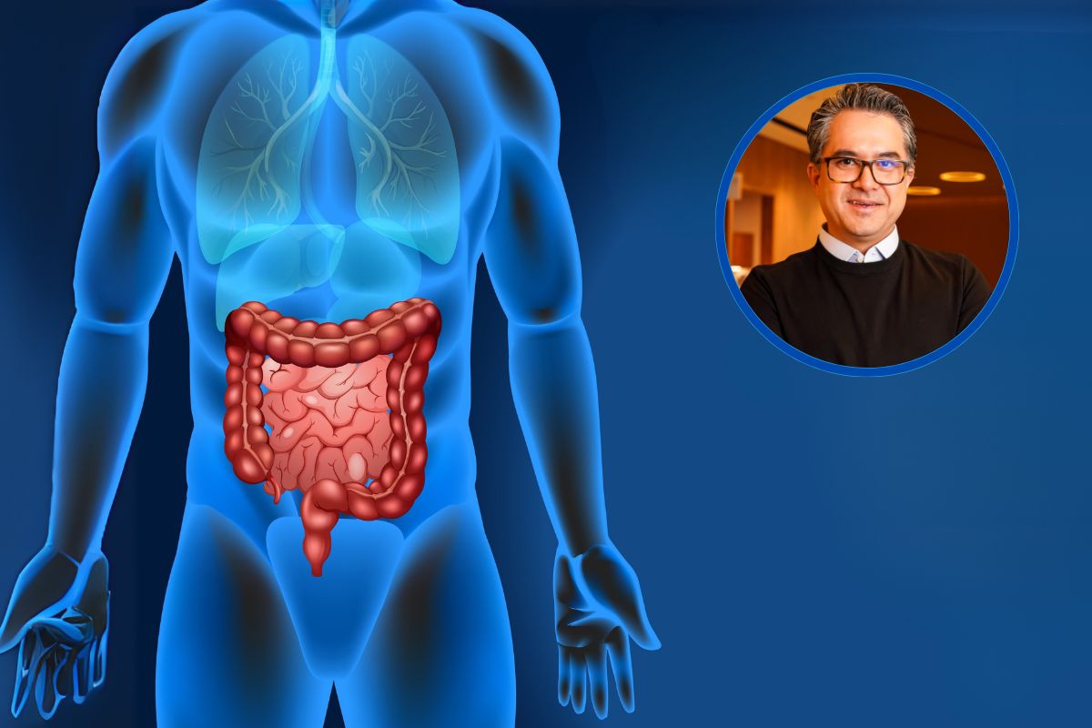 Câncer de intestino em jovens aumenta silenciosamente e especialista pede atenção urgente 1 Câncer de intestino em jovens.