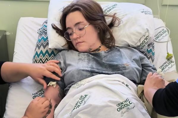 O que é neuralgia do trigêmeo e por que até um toque no rosto causa dor insuportável 2 Carolina Arruda
