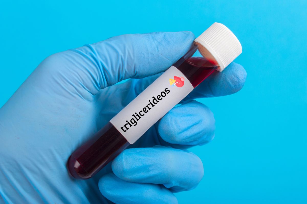 Triglicerídeos baixo no exame de sangue: é bom ou pode ser sinal de alerta? 1 triglicerídeos baixo.