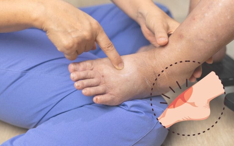 sinais de má circulação.