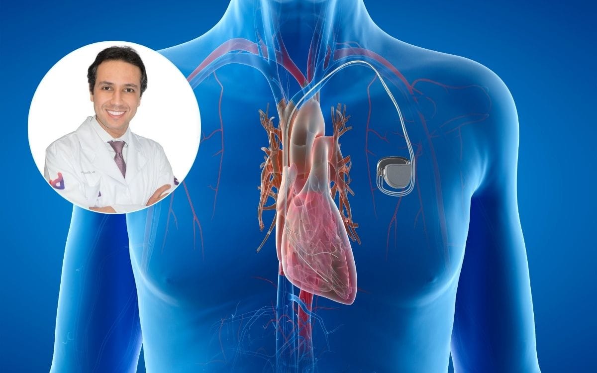 Nova técnica revoluciona tratamento de arritmias cardíacas 1 arritmias cardíacas.