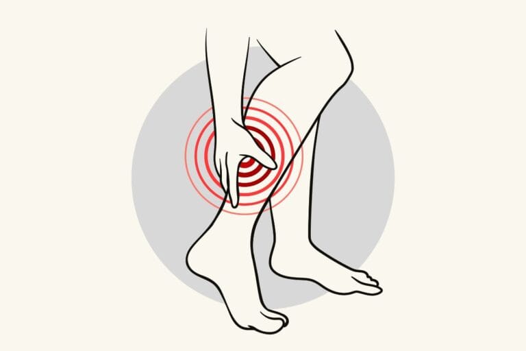 Cansaço e dor nas pernas: o que pode estar por trás do sintoma e quando procurar ajuda 6 cansaço e dor nas pernas.