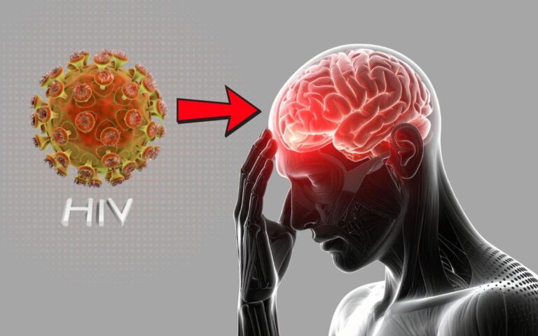 Por que o HIV no cérebro é tão difícil de eliminar? Estudo traz novas pistas 6 HIV no cérebro.