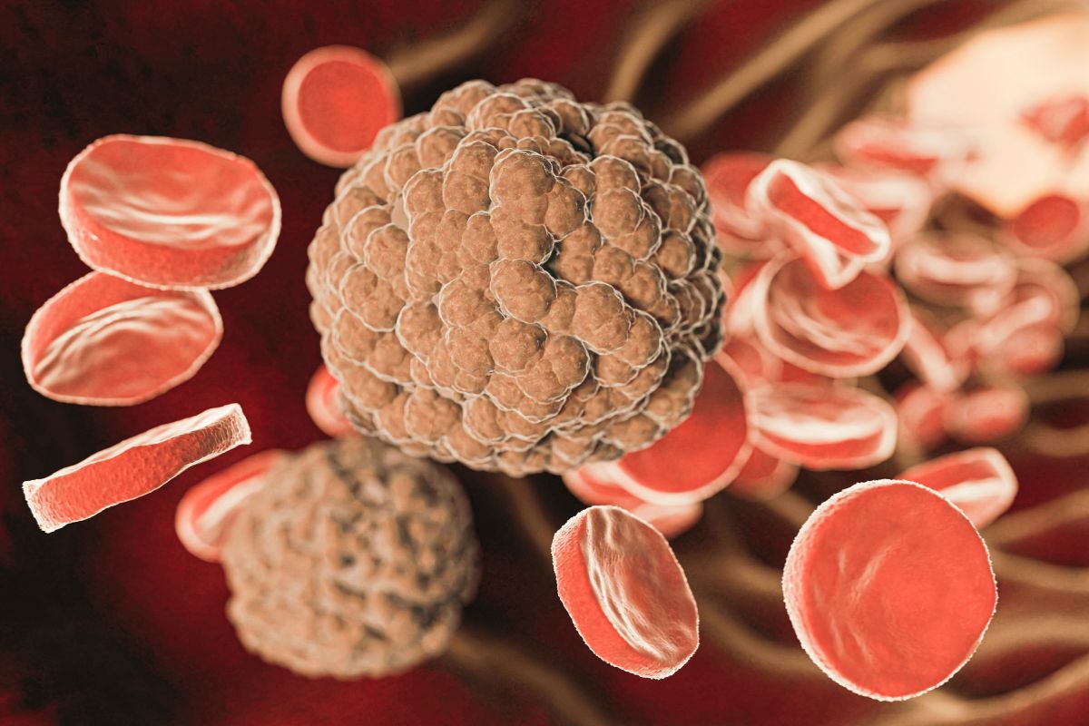 Eosinófilos acima do normal: o que pode ser e quando se preocupar 1 eosinófilos acima do normal.