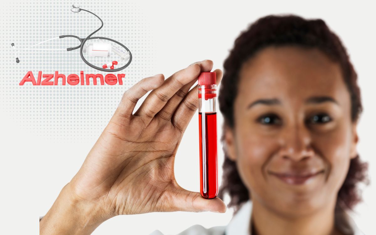 Um simples exame de sangue pode revelar os primeiros sinais do Alzheimer; entenda mais 1 exame de sangue para detectar Alzheimer.