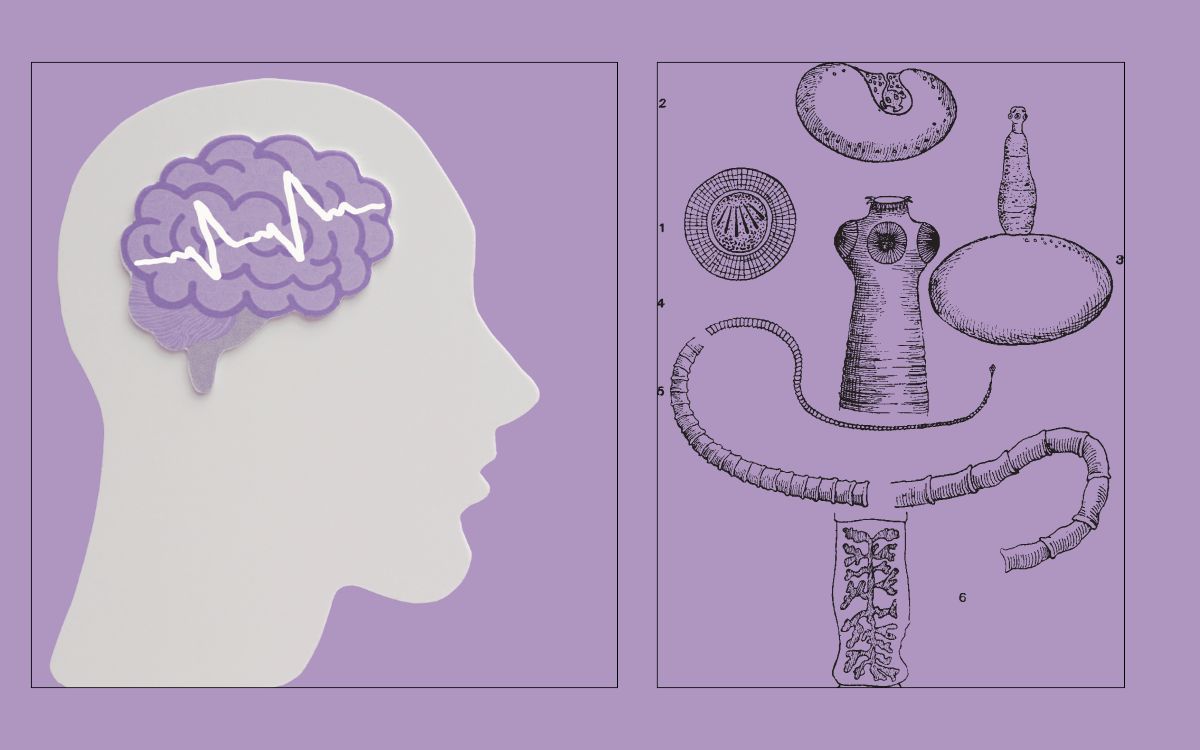 A doença silenciosa que provoca epilepsia: entenda a neurocisticercose 1 neurocisticercose.