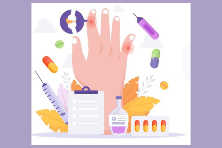 O que piora a artrite reumatoide: hábitos e alimentos que agravam os sintomas 2 o que piora a artrite reumatoide.