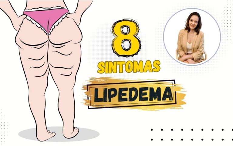 sintomas de lipedema.