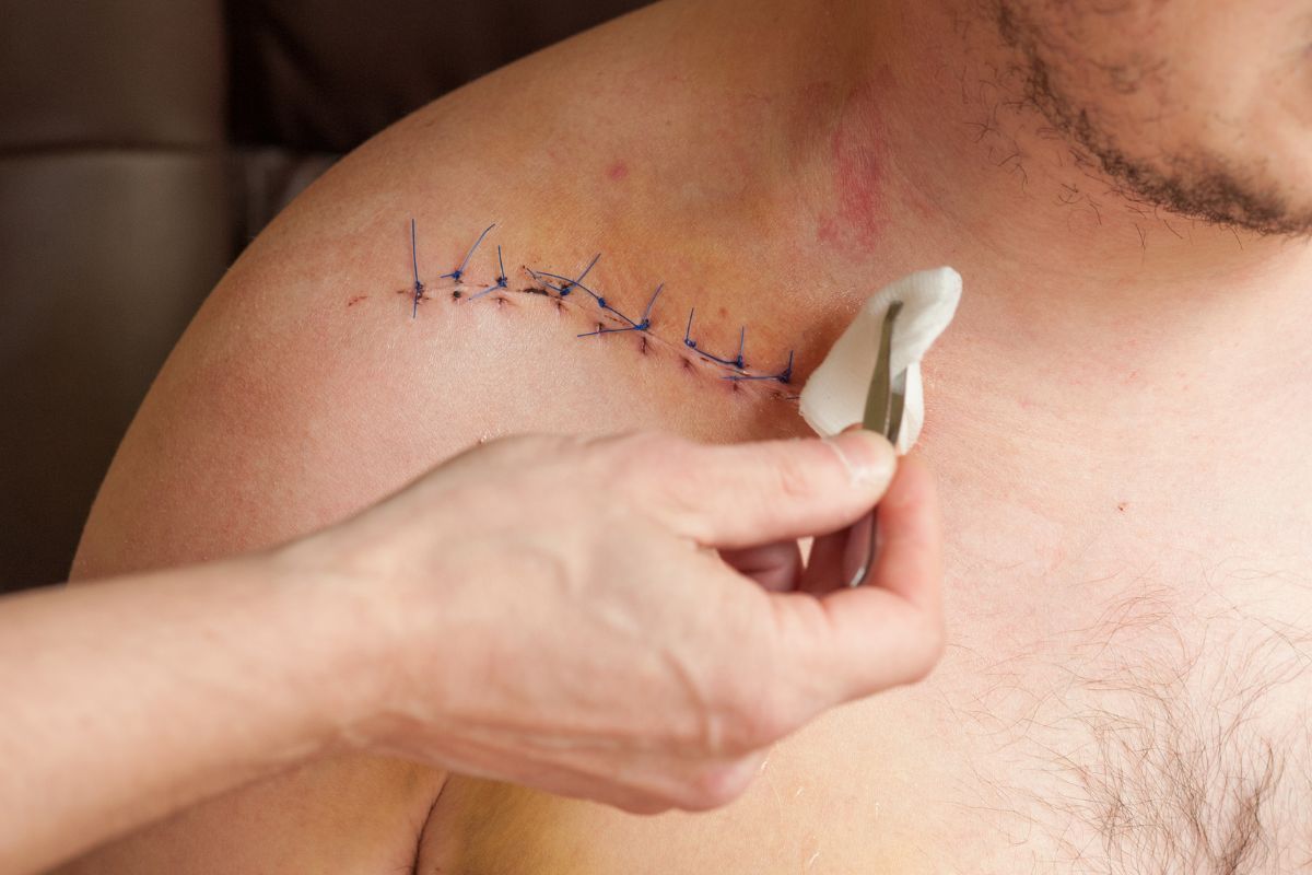 Como saber se o ponto abriu: sinais, o que fazer e quando procurar ajuda 1 Como saber se o ponto abriu.