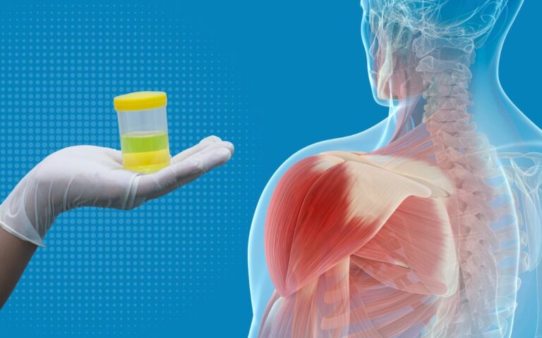 Corpos cetônicos: o que seus músculos têm a ver com a cetona na urina 2 Corpos cetônicos.