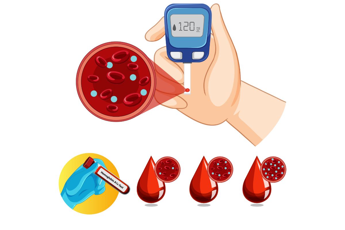 Exame de hemoglobina glicada.