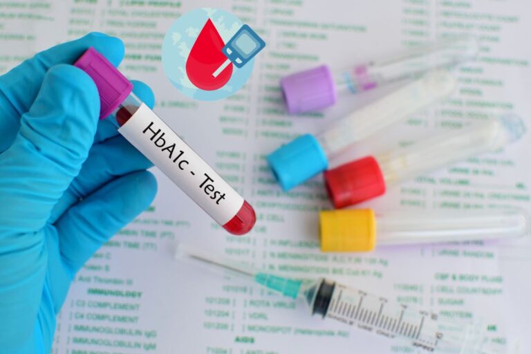 hemoglobina glicada alta e glicose normal.