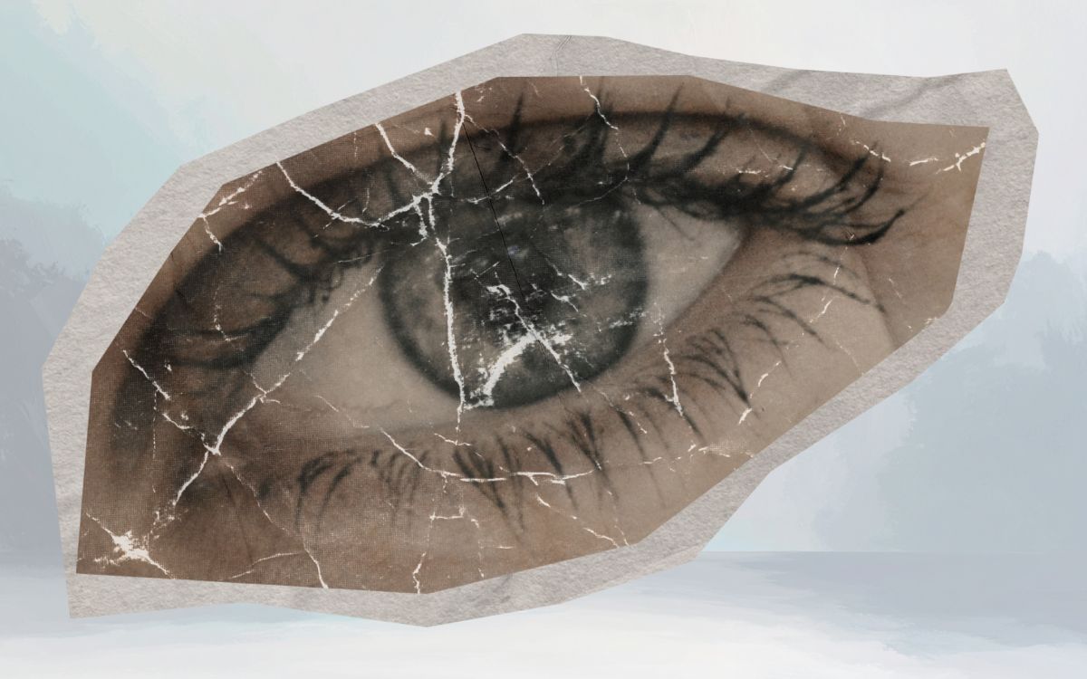 sequelas de AVC nos olhos.