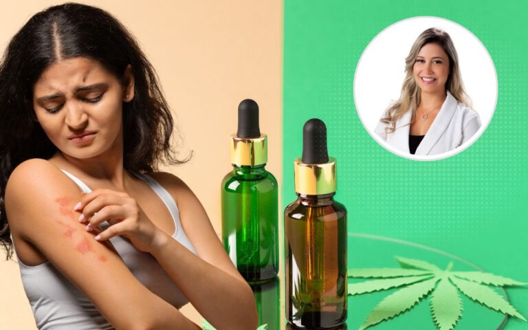 CBD na dermatologia: o papel da cannabis no tratamento de doenças de pele 1 CBD na dermatologia.