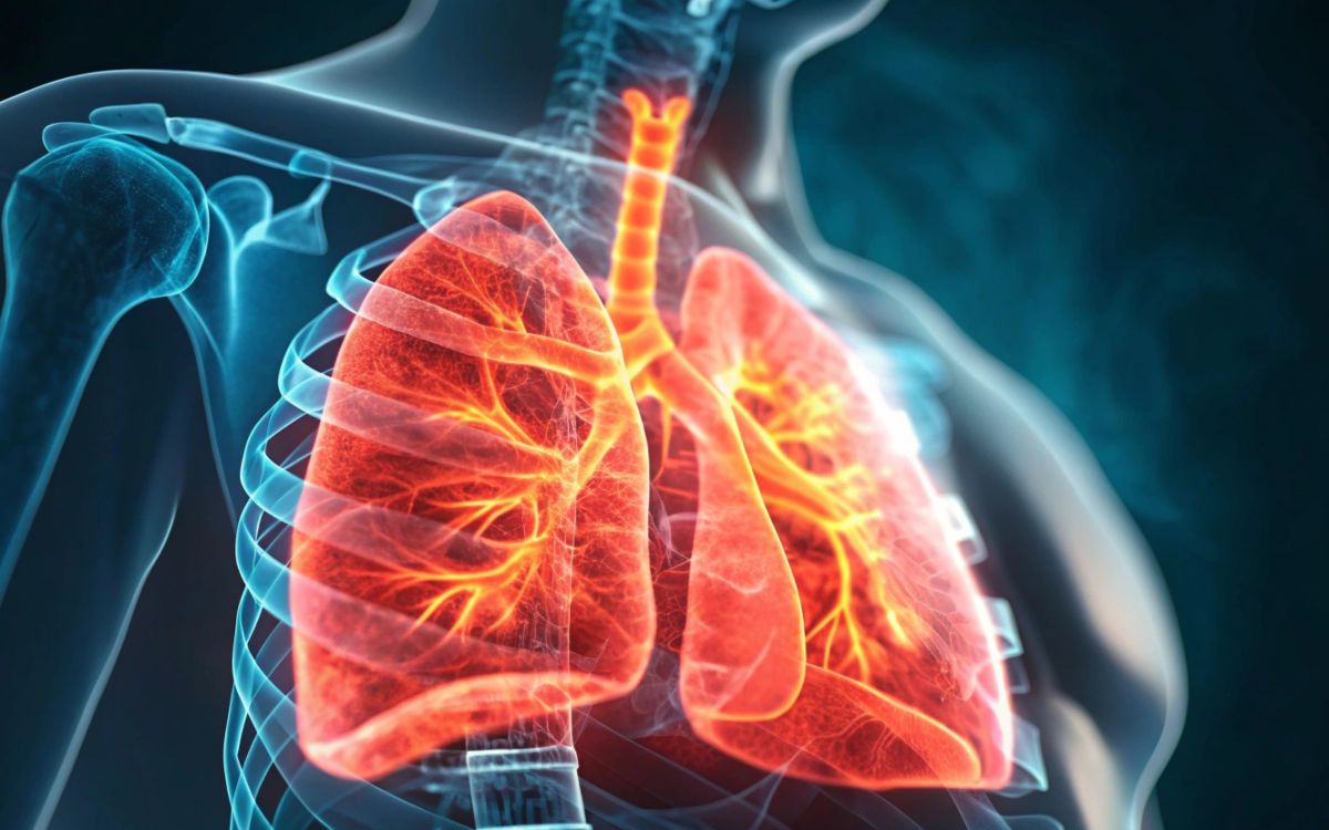 Tuberculose no Brasil.