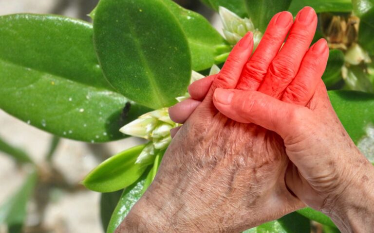 Tratamento natural para artrite? O que a ciência começa a ver numa planta brasileira 3 planta brasileira contra artrite
