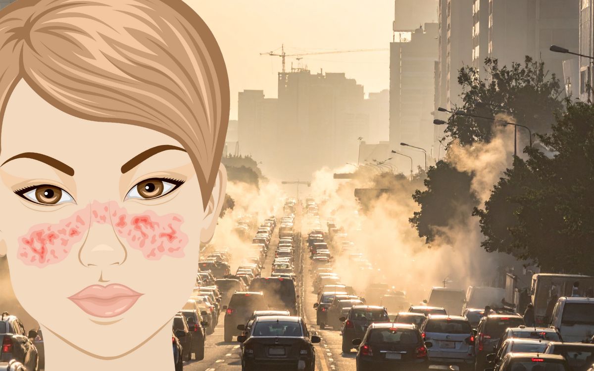 poluição do ar e doenças autoimunes.