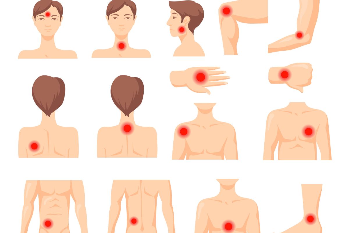 Tender point: o que é, por que dói e qual a relação com a fibromialgia 1 tender point