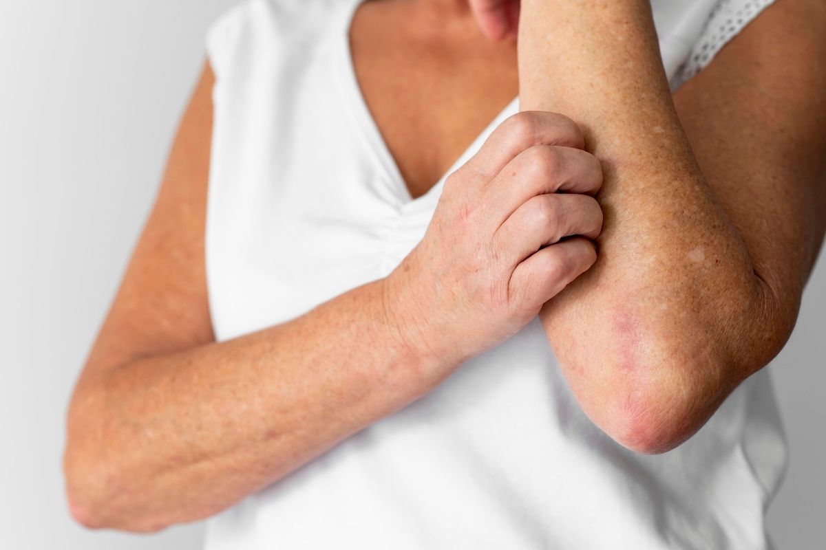 Coceira no corpo sem manchas: o que o seu corpo pode estar tentando avisar 1 Coceira no corpo sem nada aparente;