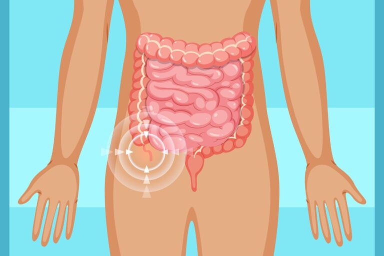 como é a dor de apendicite.