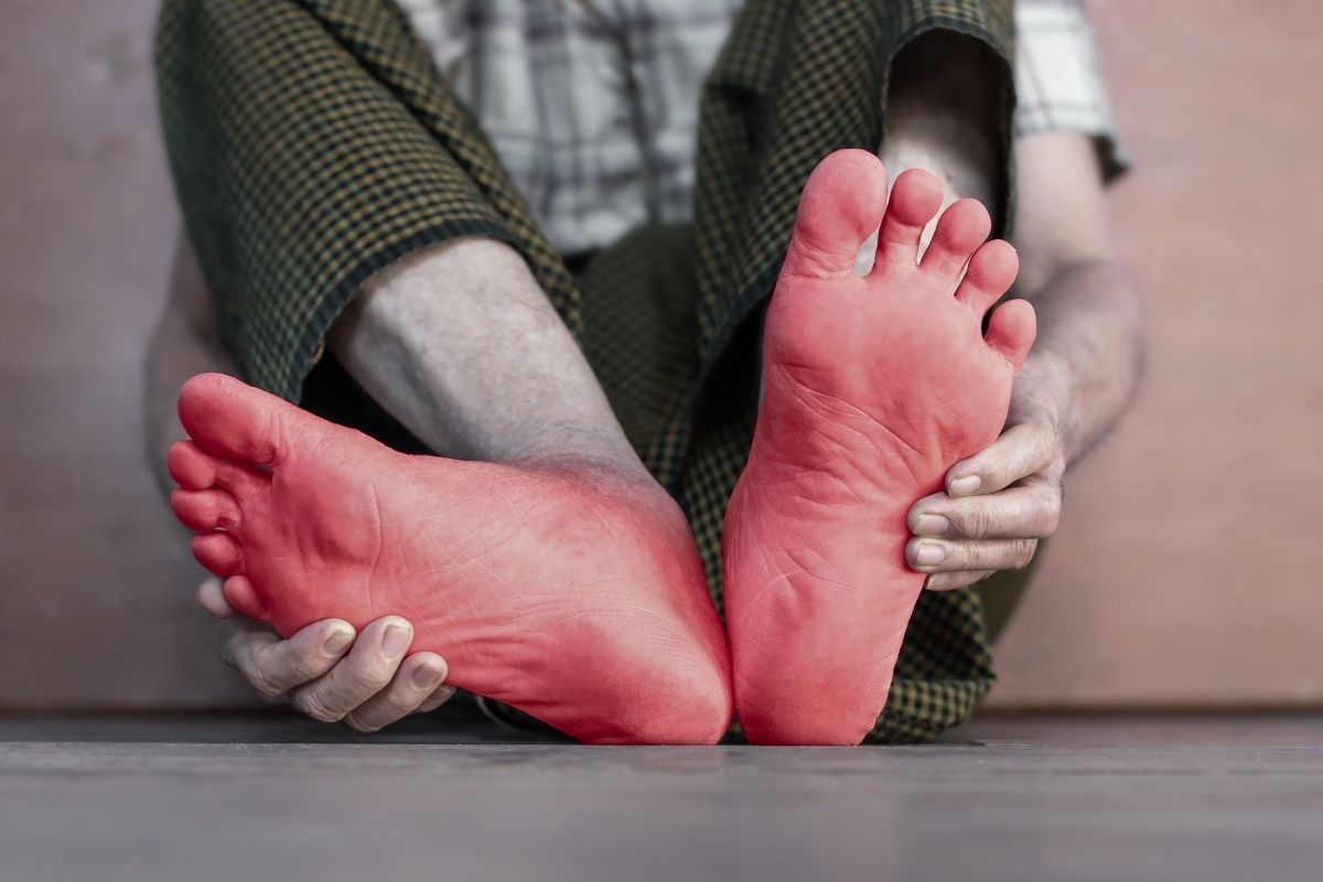 dormência e formigamento.