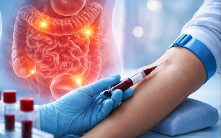 exame de sangue para doença de Crohn.