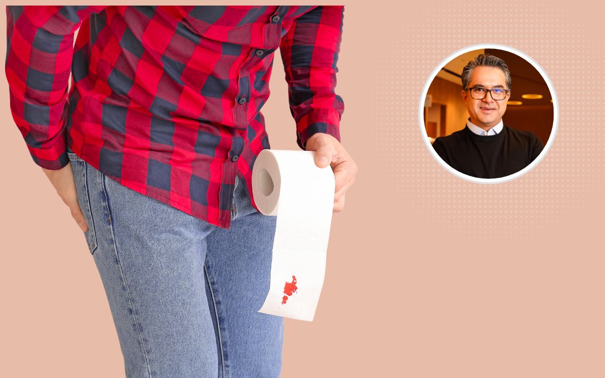 hemorroidas ou câncer colorretal.