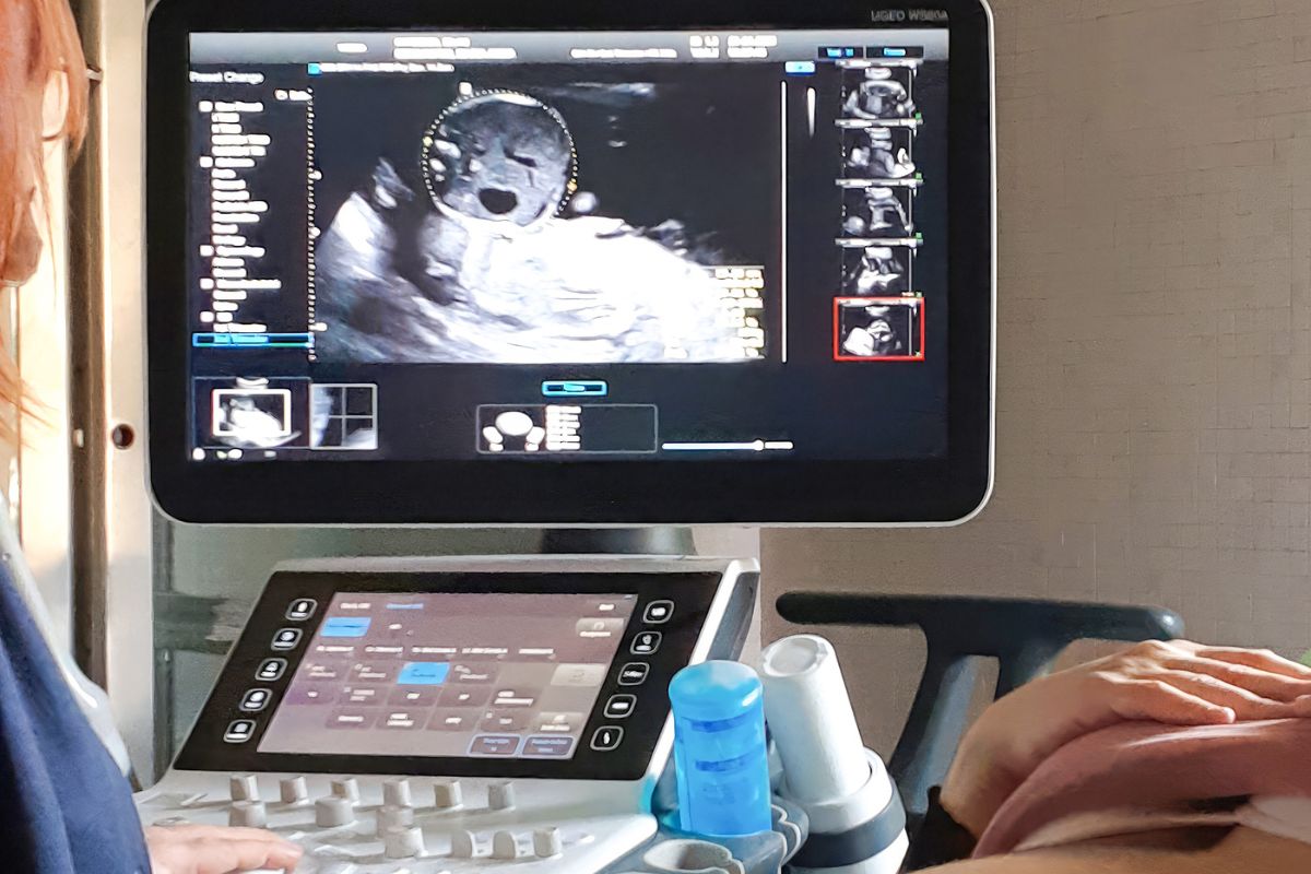 ultrassonografia pélvica como é feito.