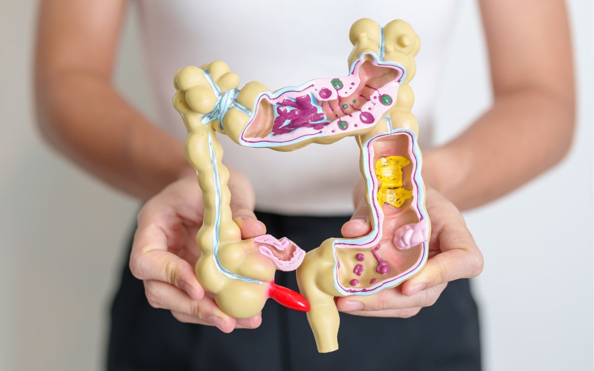 Como é o câncer colorretal