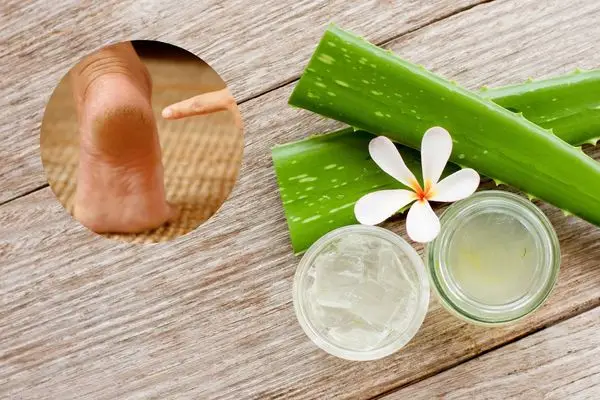 Babosa para pés ressecados e grossos.