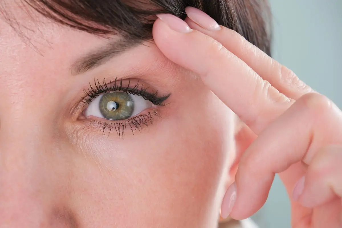 Blefaroplastia.