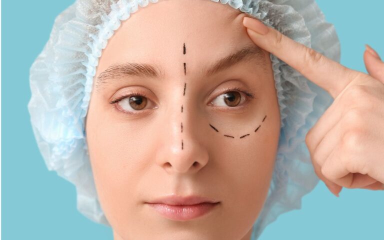 Pálpebras caídas, olhar cansado: quando a blefaroplastia pode fazer sentido? 2 Blefaroplastia
