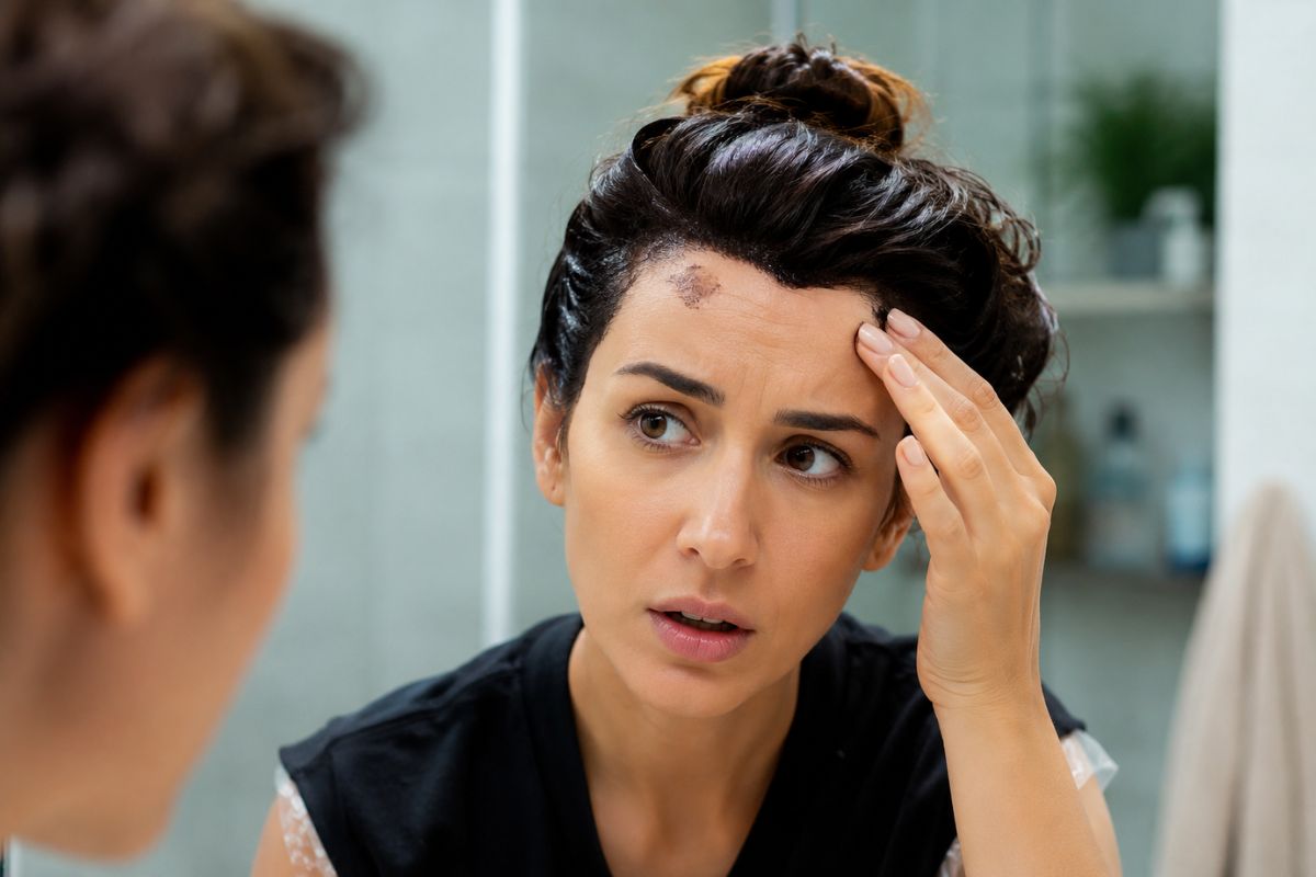 Tingiu o cabelo e manchou a pele? Veja como remover sem sofrimento 1 Como tirar mancha de tinta de cabelo da pele.