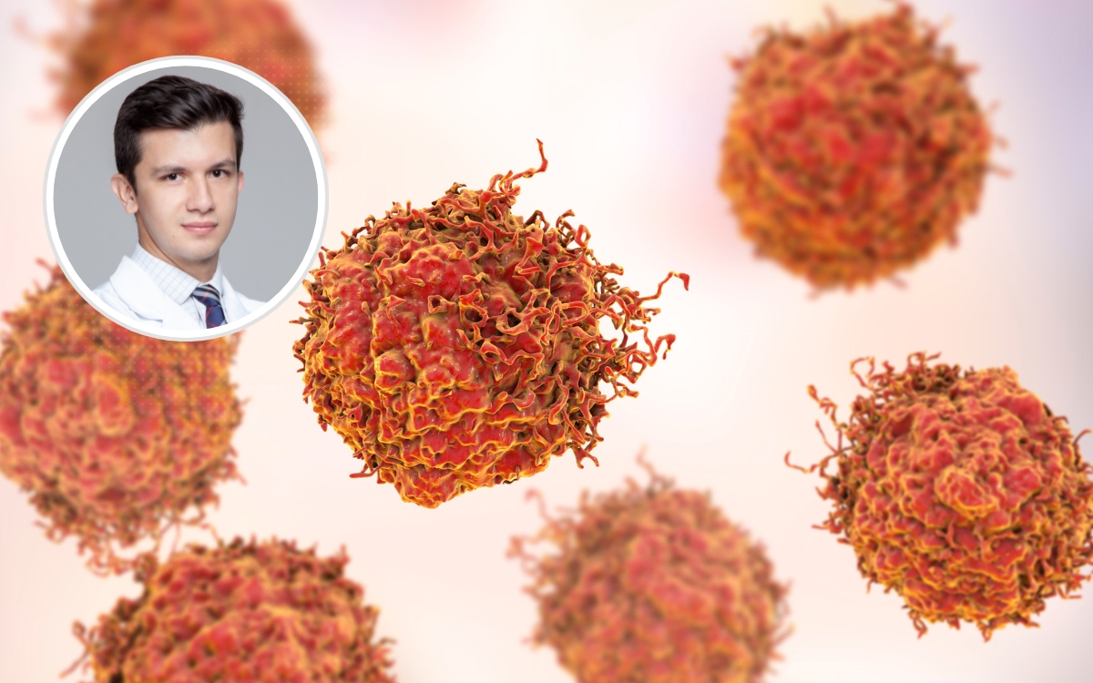 Novo tratamento para câncer de próstata avançado: oncologista explica quem pode se beneficiar 2 Câncer de próstata avançado