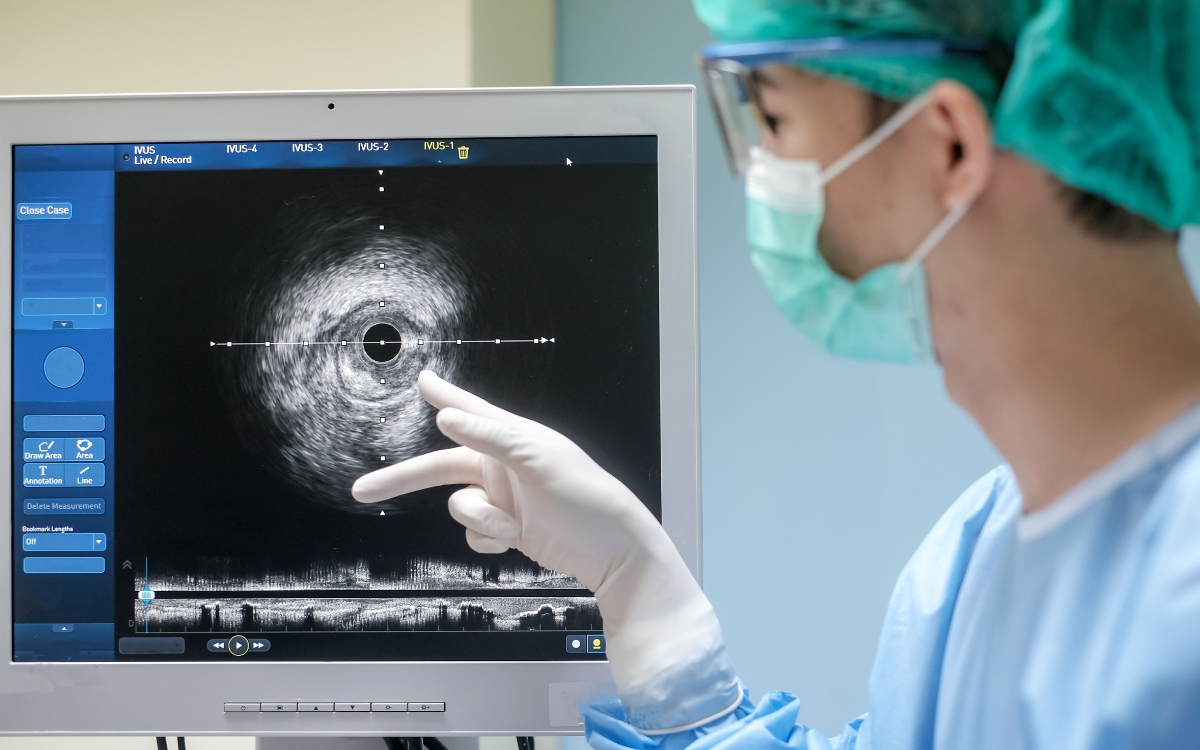 Cateterismo cardíaco: exame, cirurgia ou os dois? 1 Cateterismo é um exame ou uma cirurgia
