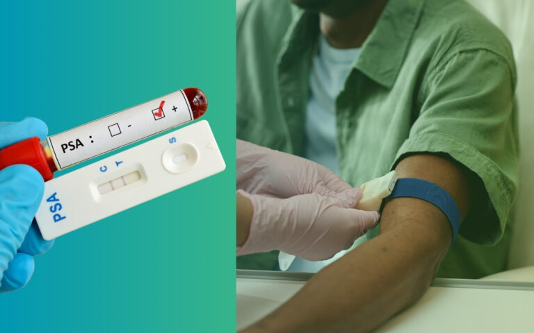 Exame de sangue para próstata