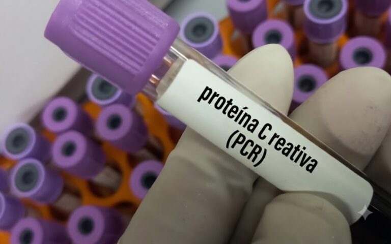 O que é proteína C reativa