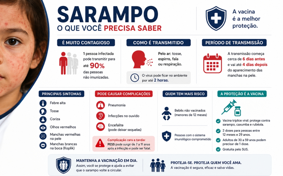 Sarampo é contagioso? Quem corre mais risco? Tire as principais dúvidas 2 Sarampo é contagioso