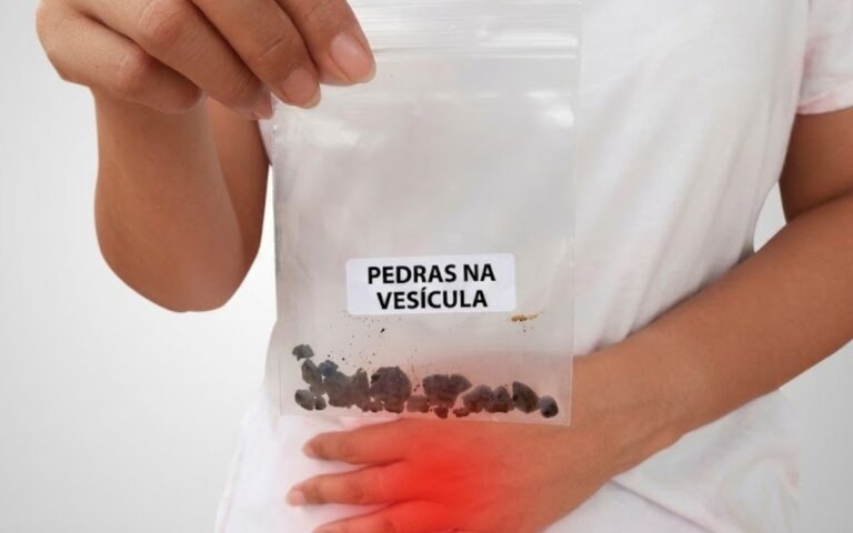Quais os sintomas de pedra na vesícula