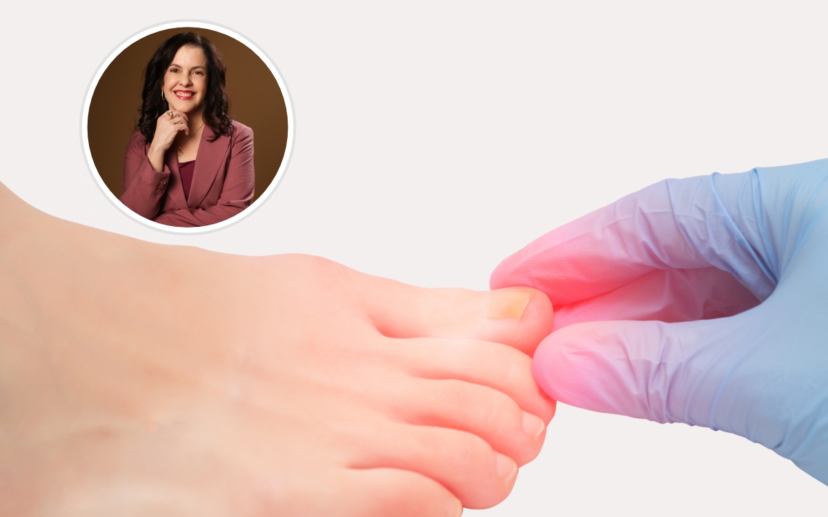 Micose e unhas esfarelando: o que significa? 1 Micose nas unhas