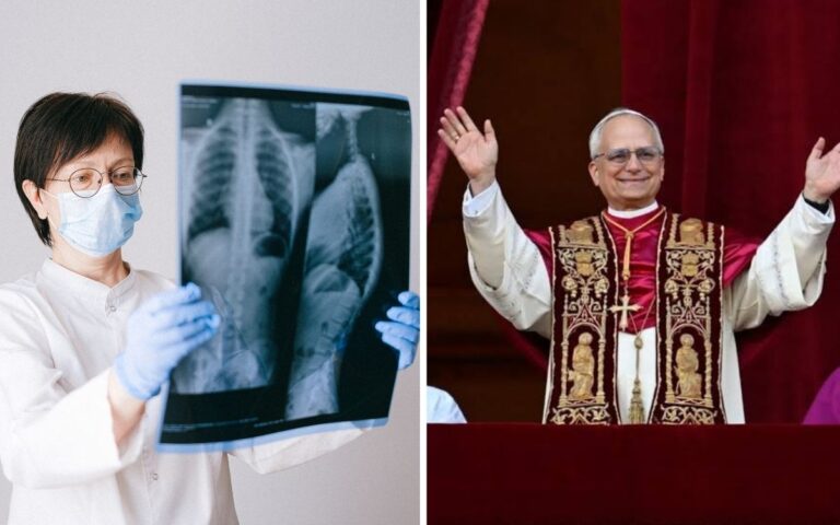 Nódulo pulmonar é sempre câncer? Entenda o caso do papa Leão XIV 3 Nódulo pulmonar