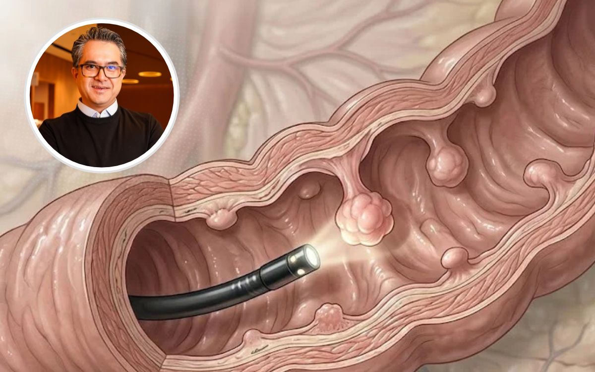 Abri o laudo da colonoscopia e li ‘pólipo’. A primeira coisa que pensei foi: é câncer? 1 Pólipo intestinal.